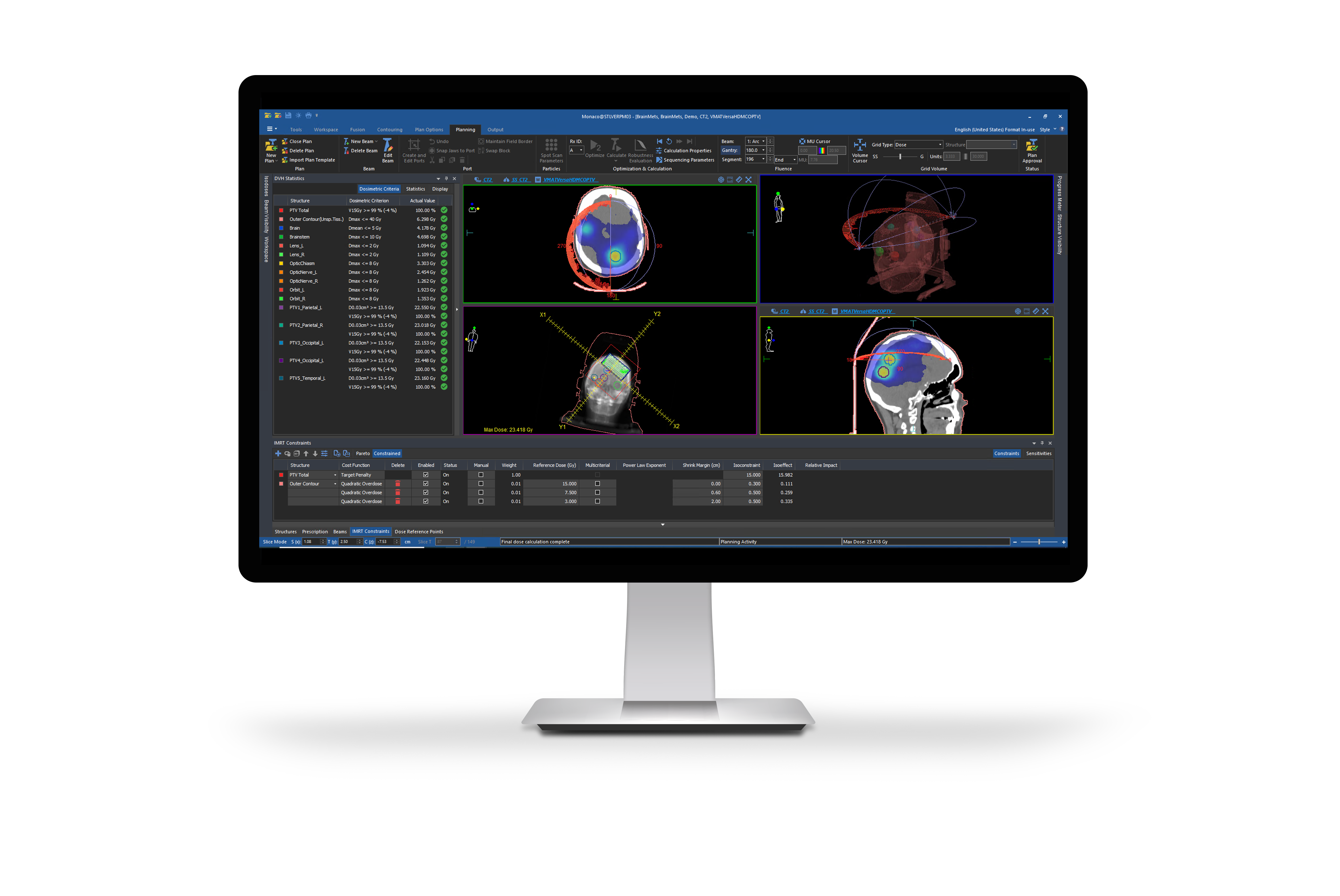 Elekta ONE Planning Monitor